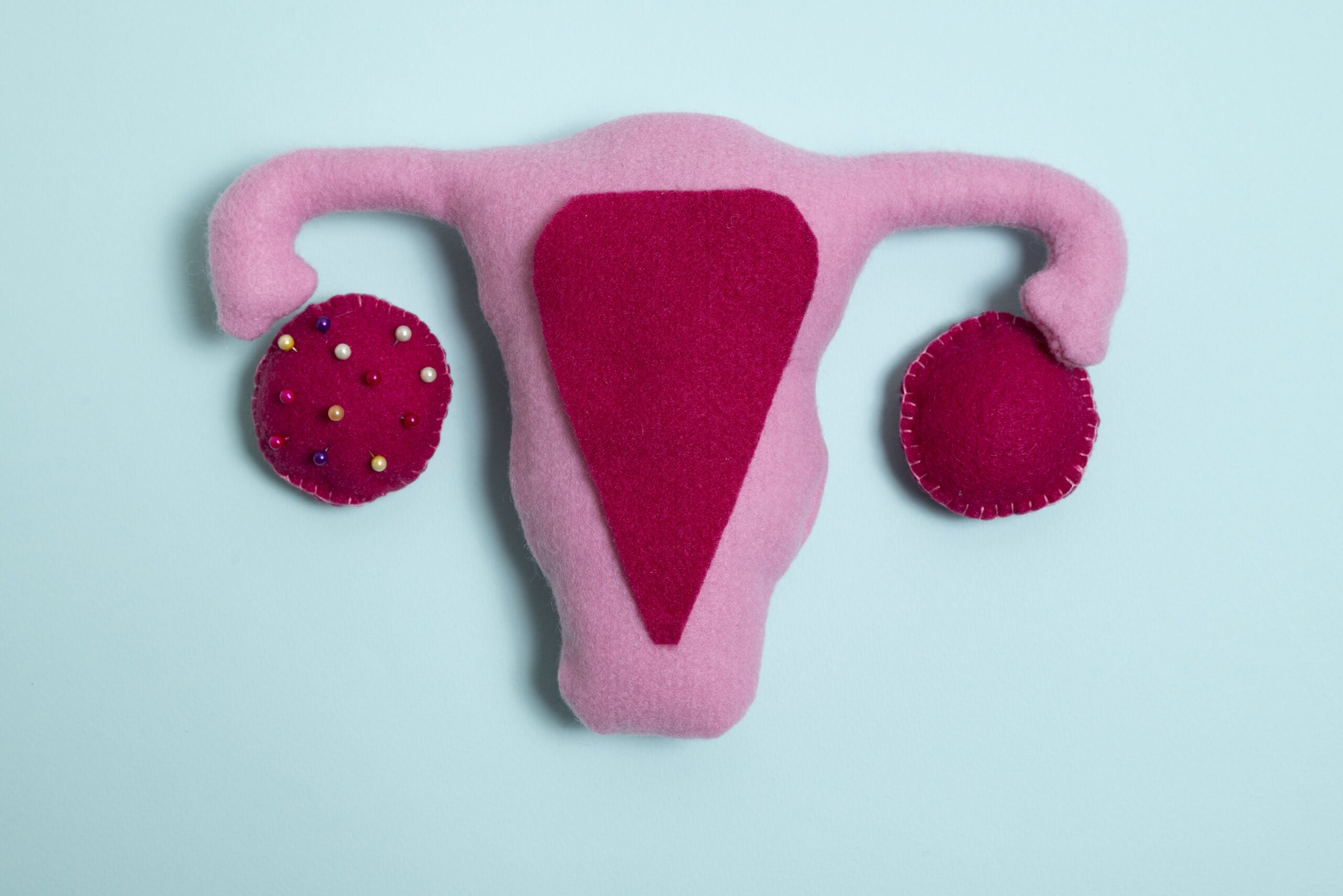 pcos, women, period, menstrual, polycystic ovaries