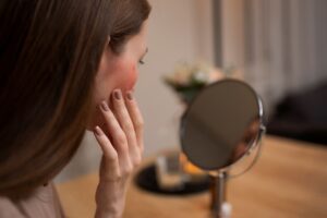 διατροφή και ροδόχρους νόσος, διατροφή, διαιτολόγος, nutrition home